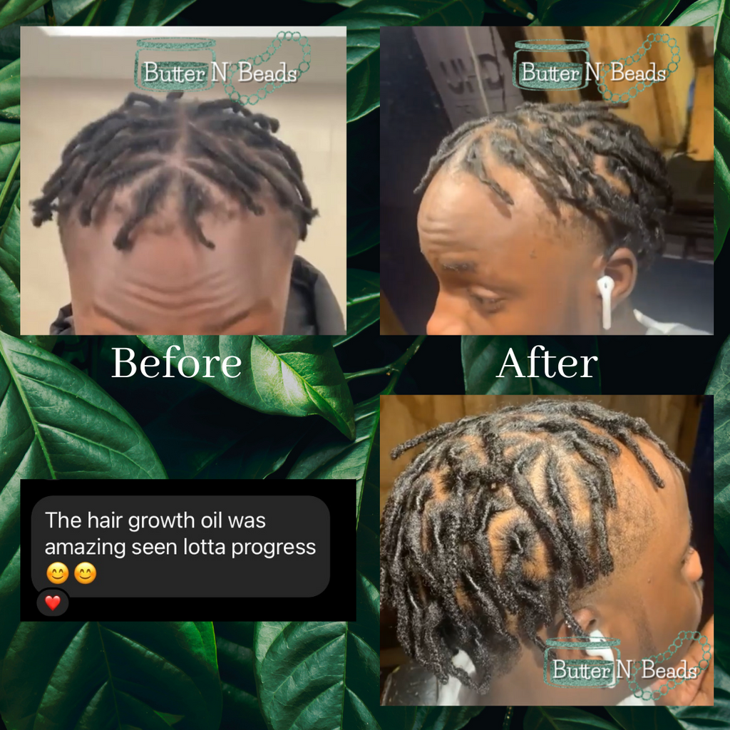 All Natural Hair Growth Oil