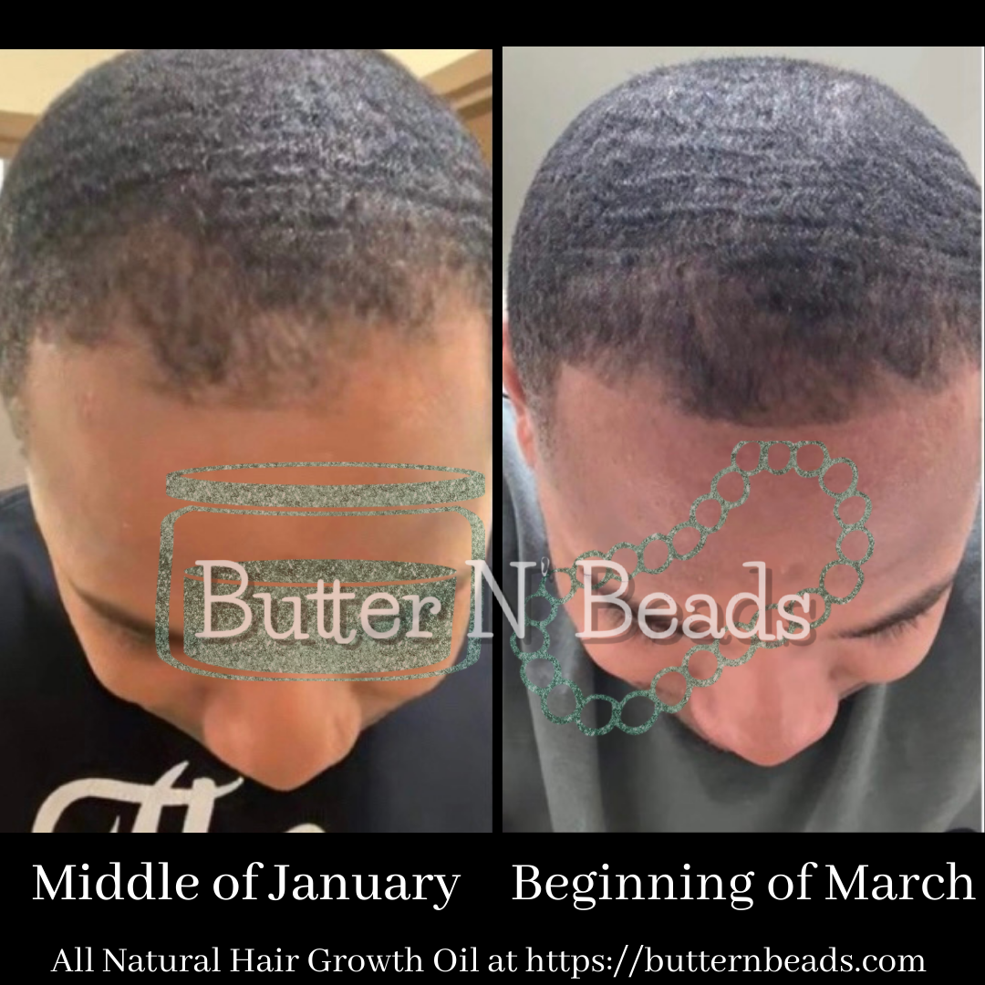 All Natural Hair Growth Oil